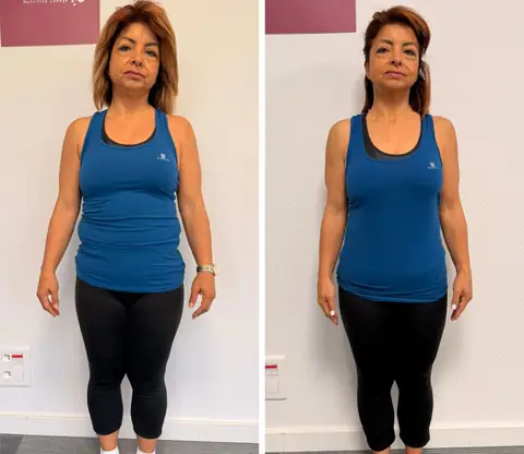Avant puis après, une adhérente de Healthy nutrition Labège vue de face